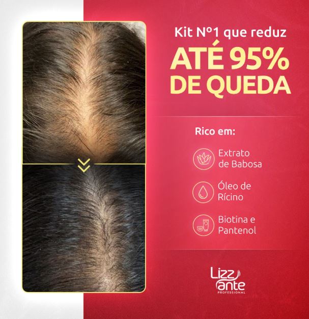 Tratamento completo com Kit S.O.S Crescimento Capilar passo a passo.