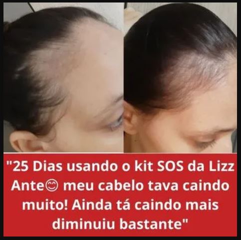 Kit S.O.S Crescimento Capilar indicado para todos os tipos de cabelo.