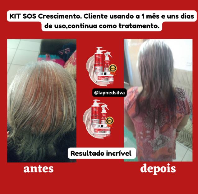 Kit S.O.S Crescimento Capilar melhora brilho e resistência dos fios.