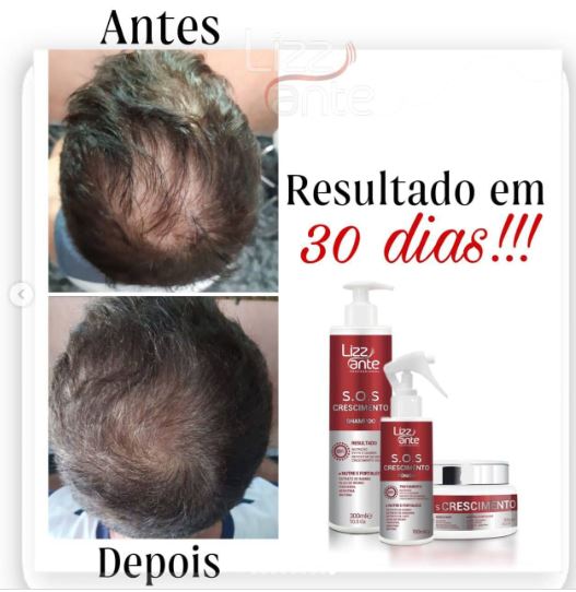 Resultados rápidos com Kit S.O.S Crescimento Capilar comprovado.