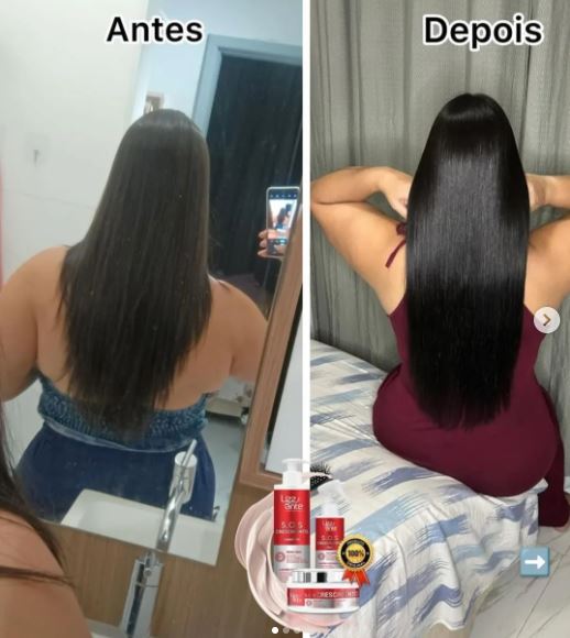 Kit S.O.S Crescimento Capilar com tônico poderoso para crescimento.