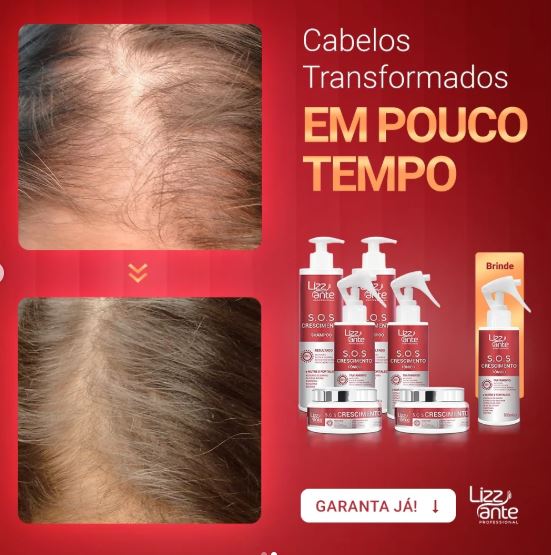 Kit S.O.S Crescimento Capilar para cabelos fracos e quebradiços.