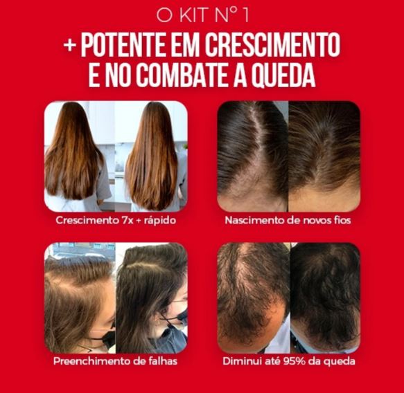 Kit S.O.S Crescimento Capilar reduz queda e fortalece raiz.