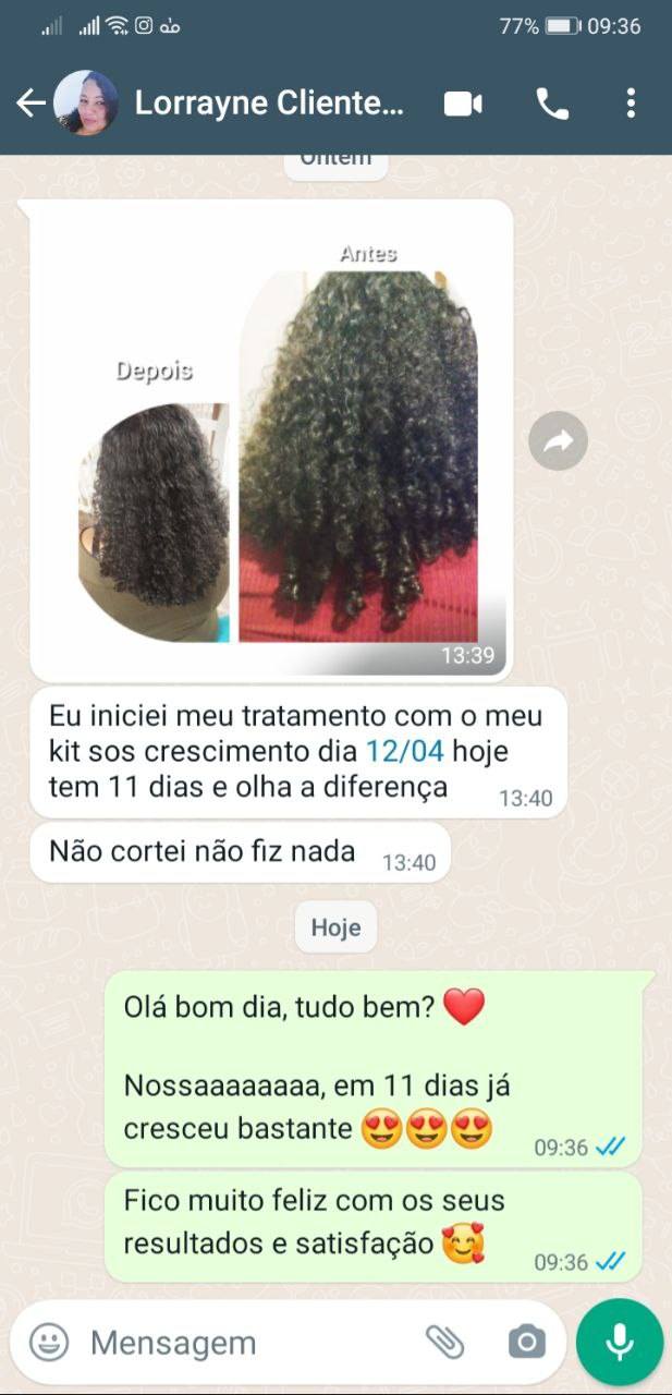 Tratamento com Kit S.O.S Crescimento Capilar para queda de cabelo.