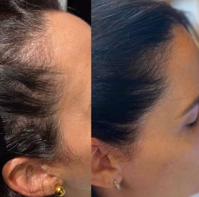 Uso do Kit S.O.S Crescimento Capilar para cabelos mais fortes.