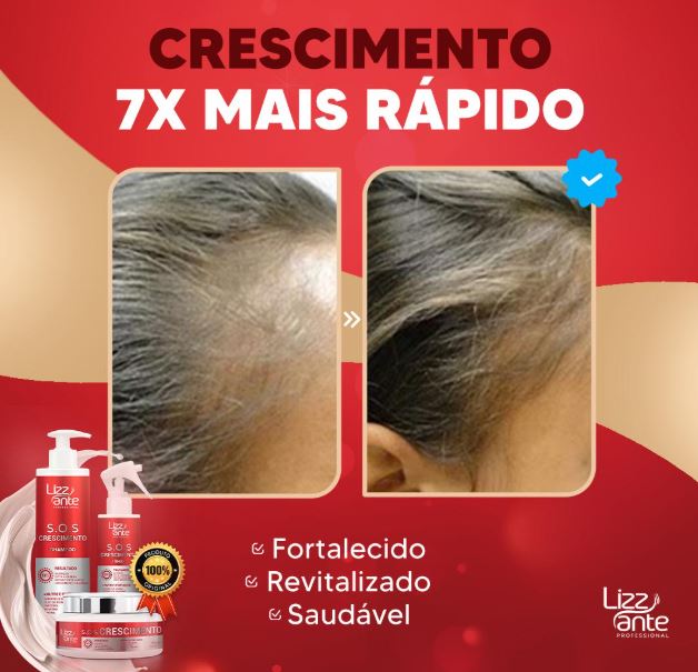 Kit S.O.S Crescimento Capilar combate queda e estimula crescimento.