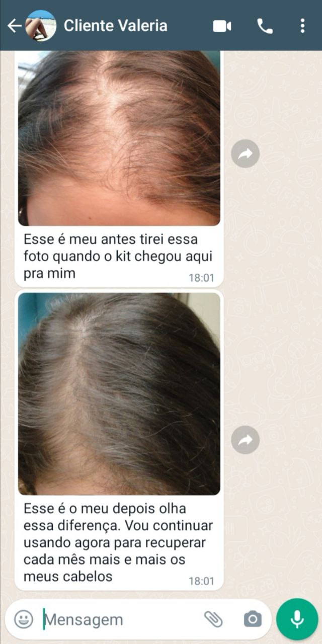 Fotos reais de resultados com Kit S.O.S Crescimento Capilar.